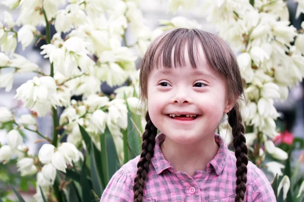 CU Uncovers a “Game-Changing Discovery” in Down Syndrome