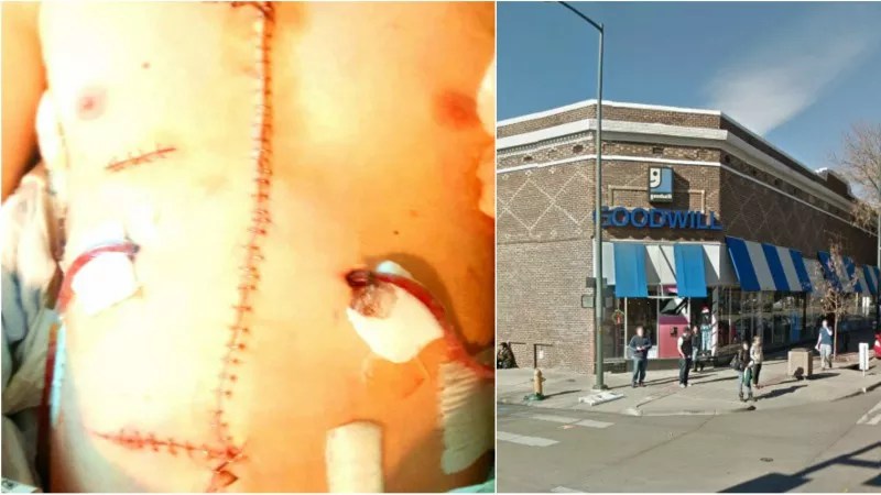 Why Charges Weren’t Filed Even Though Stabbing Victim Was Gutted Like a Fish