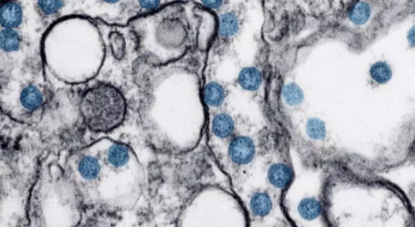 COVID-19: Testing Strategy, Polis on Possible Stay-at-Home Extension