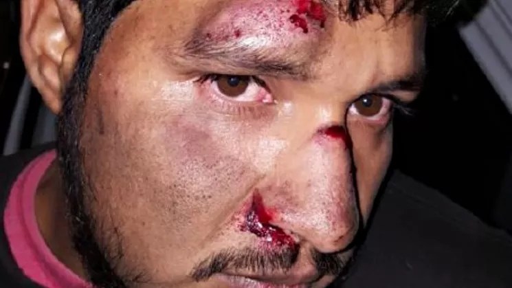 Aurora Pays $285K for Yet Another Police Attack on Person of Color